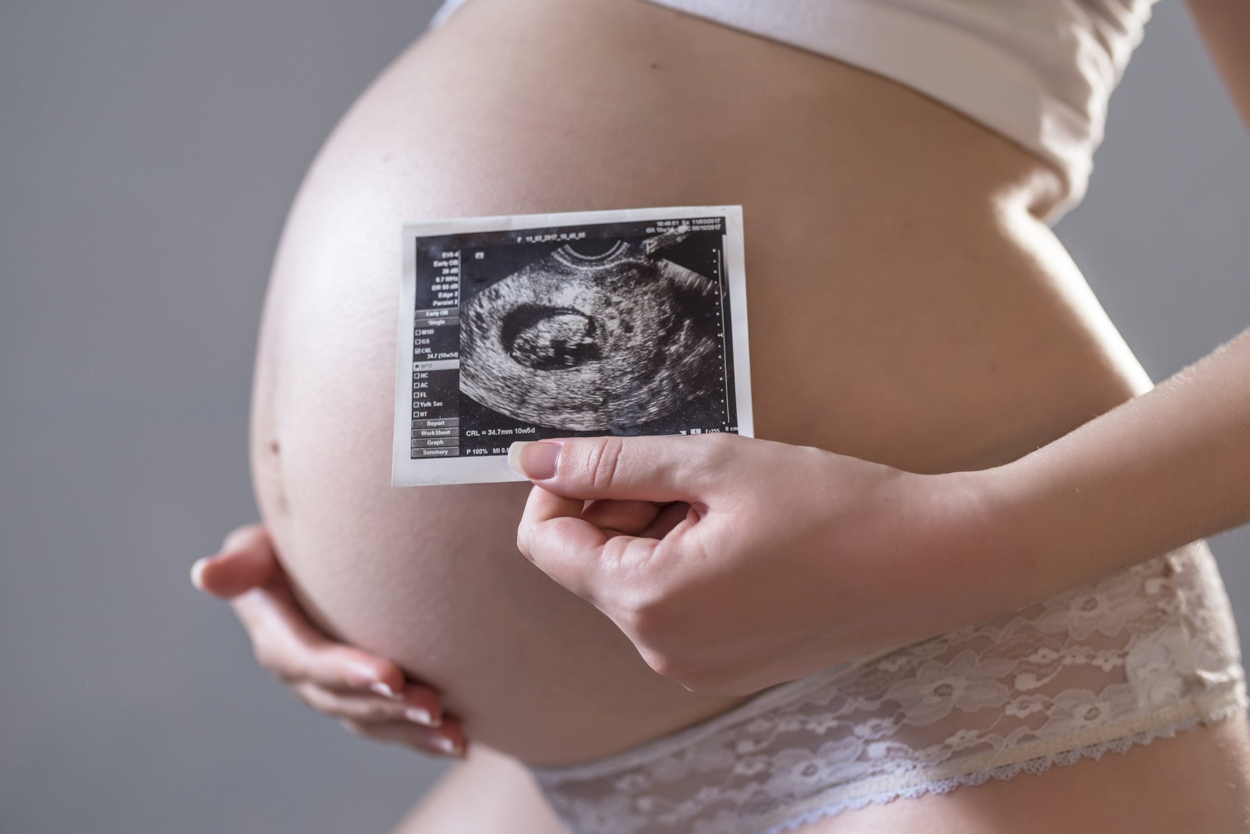 Недели беременности ру. УЗИ беременных женщин. Снимки беременности.